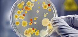 فريق بحثي من الكلية يكتشف سلالتين لبكتريا Klebsiella تحمل جينات جديدة